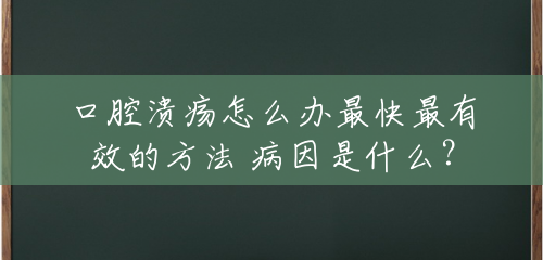 口腔溃疡怎么办最快最有效的方法 病因是什么? 口腔溃疡怎么办最快最有效的方法 病因是什么?