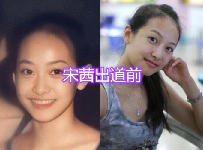 宋茜整容,郑秀晶刘宪华(朴灿烈做手术) 本文共(2159字)