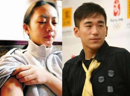 张默暴打女友童瑶,童瑶事件真相(童瑶是张默前女友吗) 本文共(5690字)