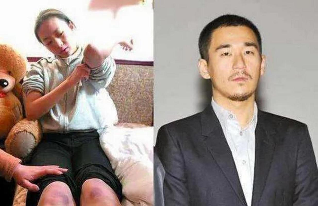 张默暴打女友童瑶,童瑶事件真相(童瑶是张默前女友吗) 本文共(5690字)