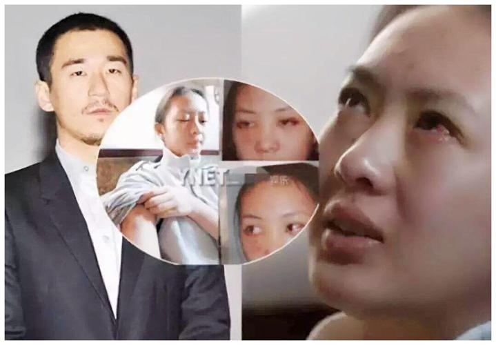 张默暴打女友童瑶，童瑶事件真相（童瑶是张默前女友吗） 本文共（5690字）