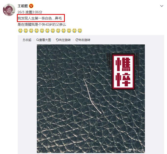 出现白鼻毛是什么原因?鼻子里长白鼻毛是有福气吗 本文共(552字)