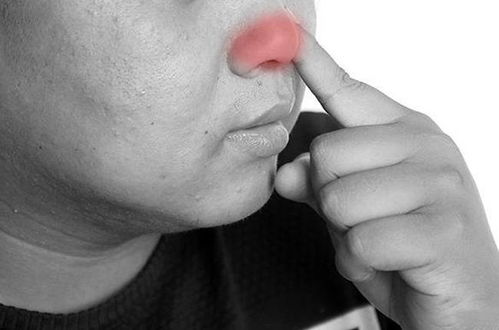 如何有效缓解一直流鼻涕的困扰？