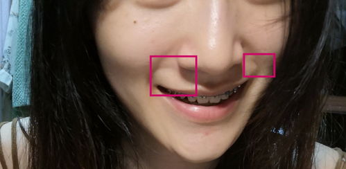 为什么会出现鼻子两侧发红的情况？