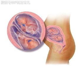 孕期，有多长时间可进行打胎手术？掌握这个时间很重要！