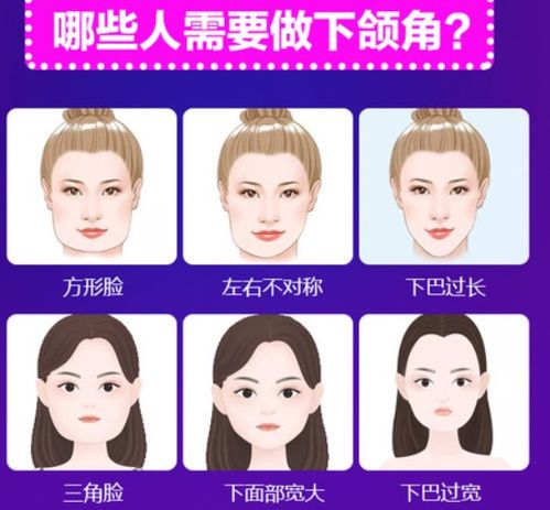 凸嘴自我矫正方法大揭秘，让你轻松改善魅力形象！
