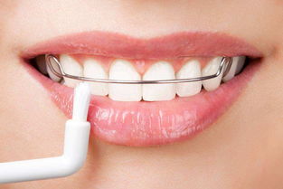 牙周宁片：让你的牙龈焕发健康光彩！