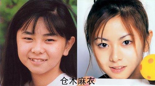龟梨和也整容,龟梨和也面相(龟梨和也为什么不红了) 本文共(2900字)