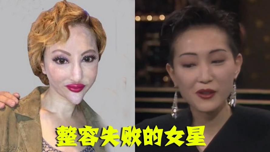 孙菲菲整容前后,冼燕坚整容前后(孙菲菲什么时候整的容)