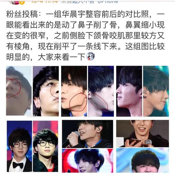 晨宇整容前后对比照片,华晨宇惊艳之作齐天大圣欣赏 本文共(1599字)