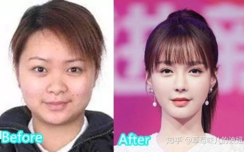 沈梦辰整容对比(沈梦辰整容之前)