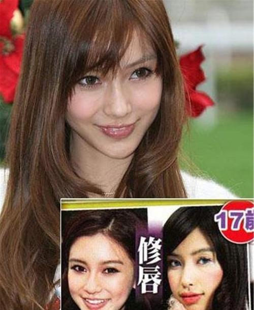 杨颖整容前后照片,baby整容前(杨颖整容前图片)