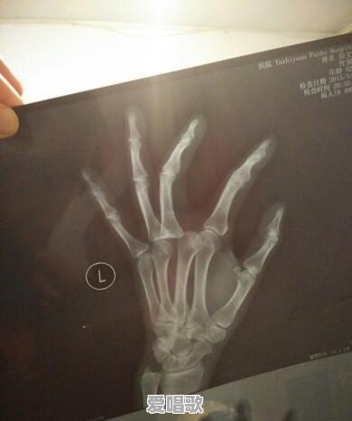 现代年轻人都有哪些发泄方式 现代年轻人都有哪些发泄方式 - 爱唱歌