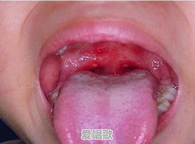为什么全民K歌有些人唱的声音挺好听?有些人唱出来效果都不是一样的,这是什么原因 为什么全民K歌有些人唱的声音挺好听?有些人唱出来效果都不是一样的,这是什么原因 - 爱唱歌