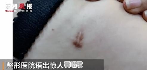 女歌手整容失败索赔120万被斥医闹，医疗集团法务部总监回应称：“还没死，100多万元是随便给的，管你是不是歌手”，你怎么看 - 爱唱歌