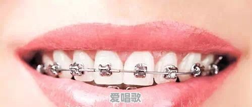 钢牙妹发朋友圈文案 钢牙妹发朋友圈文案 - 爱唱歌